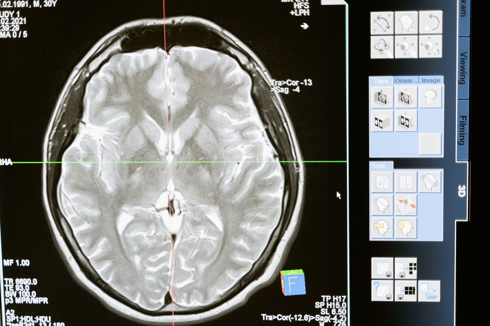 pfizer-mrna-spike-protein-found-in-deceased-man-s-brain-and-heart-peer